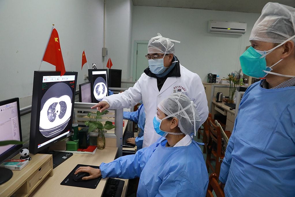 Medical workers inspect the CT (computed tomography) scan image of a patient at the Zhongnan Hospital of Wuhan University following an outbreak of the new coronavirus in Wuhan, Hubei province, China February 2, 2020. China Daily via REUTERS  ATTENTION EDITORS - THIS IMAGE WAS PROVIDED BY A THIRD PARTY. CHINA OUT.