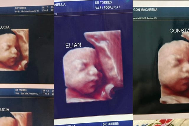 Denuncian a clínica que entregó la misma ecografía 3D a varias embarazadas
