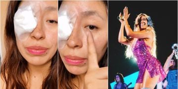 fan tuvo mala experiencia en concierto de Karol G luego de que le entrara confeti en el ojo
