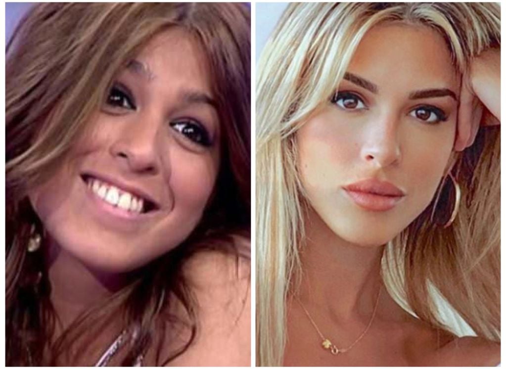 Oriana Marzoli antes y después.