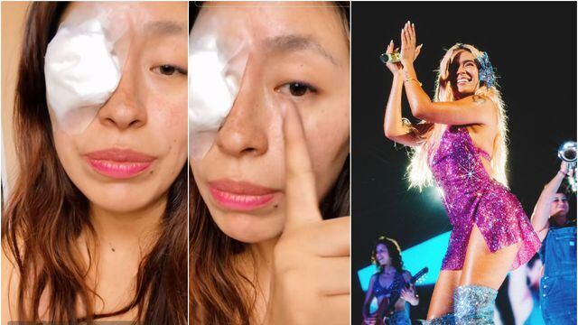 fan tuvo mala experiencia en concierto de Karol G luego de que le entrara confeti en el ojo