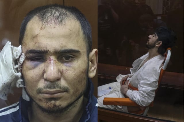 Detenidos por atentado terrorista en Rusia aparecen golpeados y desfigurados