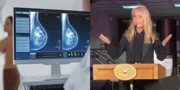 Fundación de Cecilia Bolocco ofrece mamografías gratuitas: entérate cómo acceder