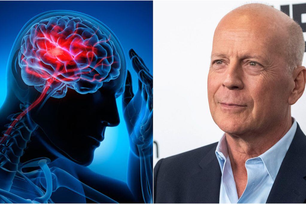 La enfermedad que dejó sin habla a Bruce Willis