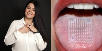 El insólito método que utilizó la actriz Paola Moreno para bajar de peso: “Me puse una malla en la lengua”