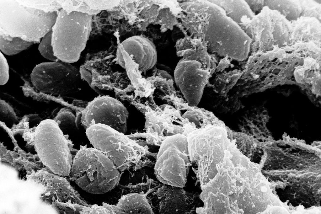 Estados Unidos confirmó caso de peste bubónica después de 8 años. Crédito: Institutos Nacionales de la Salud.