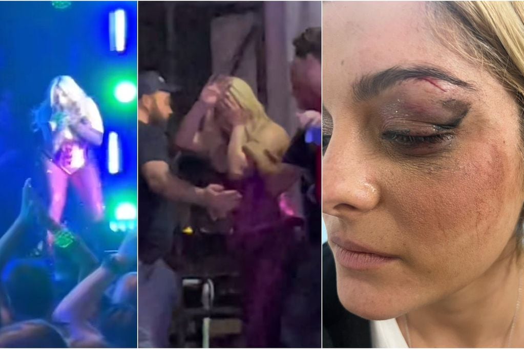 Cantante Bebe Rexha recibe brutal ataque en pleno escenario: le lanzaron celular y terminó con puntos