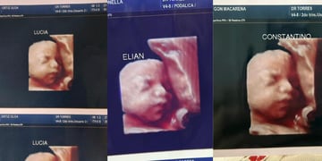 Denuncian a clínica que entregó la misma ecografía 3D a varias embarazadas