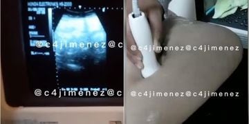 Mujer acusa a clínica privada de robarle sus mellizos tras cesárea