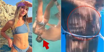 Brutal ataque de tiburón a enfermera