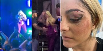 Cantante Bebe Rexha recibe brutal ataque en pleno escenario: le lanzaron celular y terminó con puntos