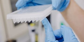 Una técnico de laboratorio prepara una PCR para el análisis de la viruela del mono.
