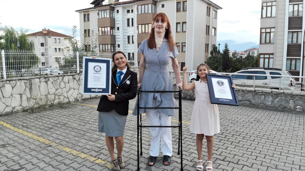 Rumeysa Gelgi, la mujer más alta del mundo.