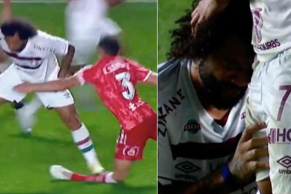 La terrible lesión que provocó Marcelo.