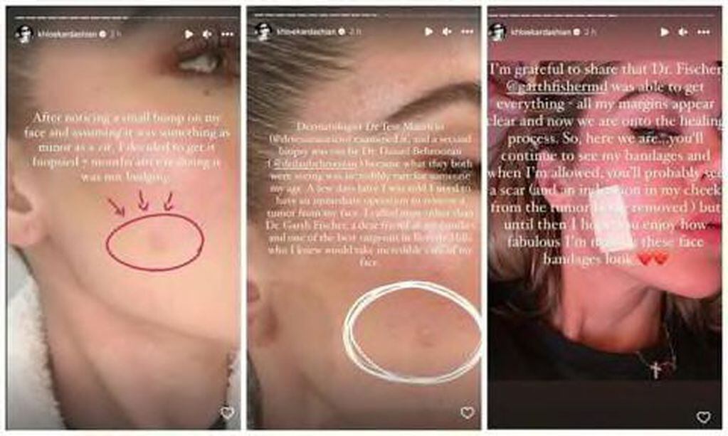 Khloé Kardashian vía Instagram
