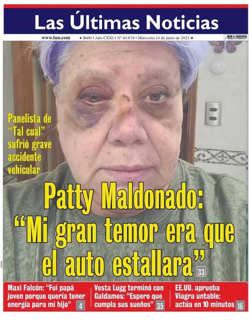 La foto de Paty Maldonado tras el accidente. (Portada de LUN)