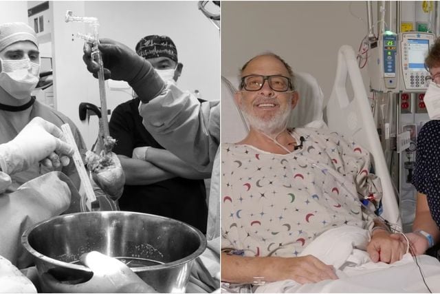 Murió segundo hombre en recibir trasplante de corazón de un cerdo: vivió sólo seis semanas