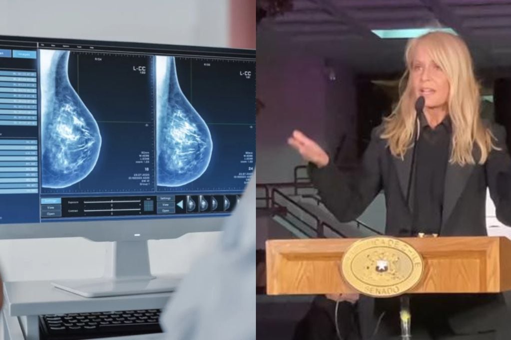 Fundación de Cecilia Bolocco ofrece mamografías gratuitas: entérate cómo acceder