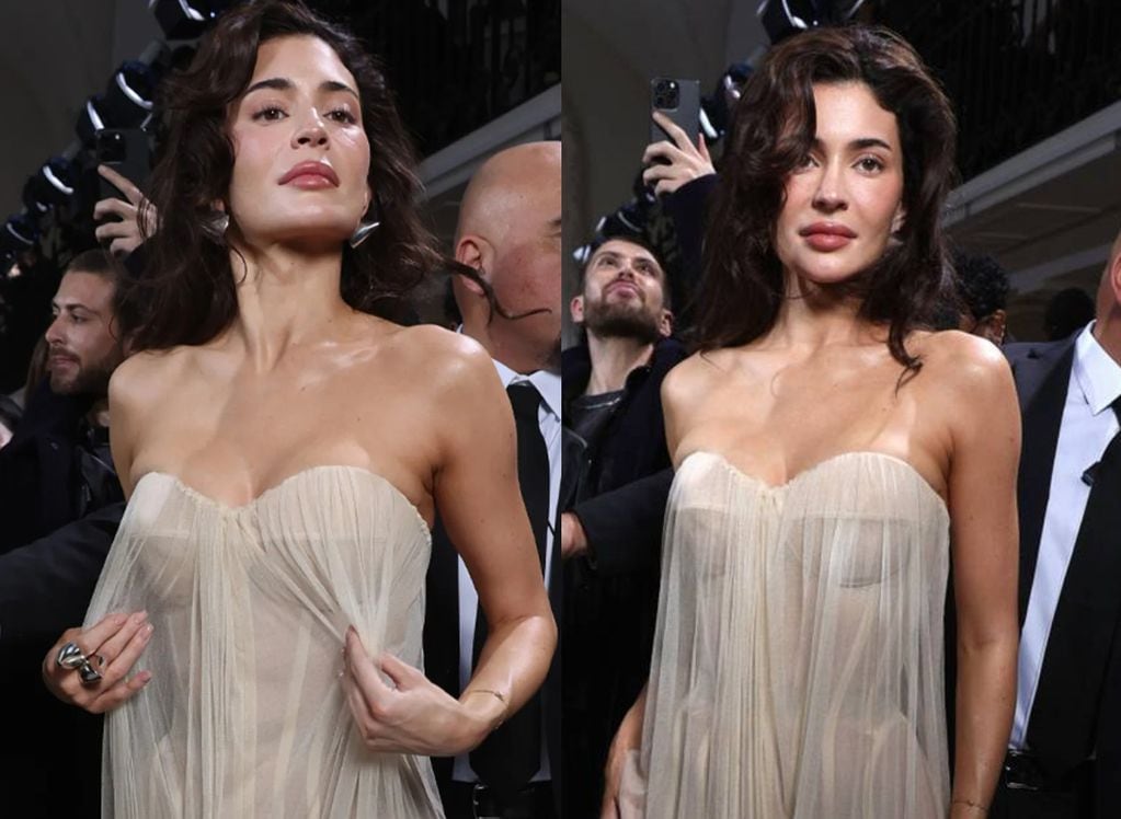 Kylie Jenner fue duramente criticada por su “rostro hinchado” en París: esta es la explicación científica