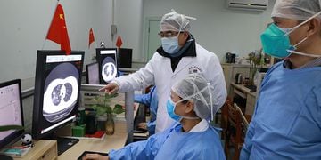 Medical workers inspect the CT scan image of a patient at the Zhongnan Hospital of Wuhan University following an outbreak of the new coronavirus in Wuhan