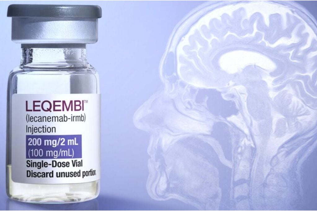 Leqembi: el primer fármaco contra el Alzheimer obtiene la aprobación total de la FDA
