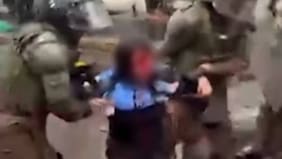 Acusaron represión, pero habría vuelco: la aclaración del gobierno tras difusión de imagen de joven herida en marcha