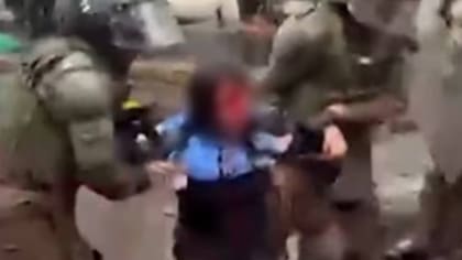 Acusaron represión, pero habría vuelco: la aclaración del gobierno tras difusión de imagen de joven herida en marcha
