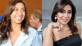 "Cuando me hablan de algo que puede ser cancerígeno, chao, no lo pienso dos veces, me lo saco...", contó Carmen Gloria Arroyo sobre la extracción de su conocido lunar