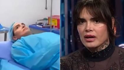 Nelson Mauri lo hizo de nuevo: impactó al mostrar su antes y después tras someterse a procedimiento estético en su rostro