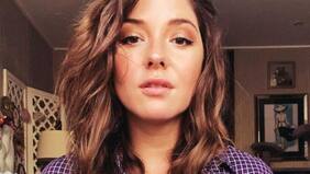 “No tengo problema…”: la confesión de Kel Calderón tras pregunta sin filtro sobre sus retoques estéticos