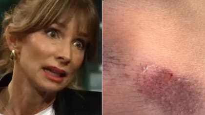 María José Prieto sufre doloroso accidente de tránsito e impacta al subir imágenes de sus heridas: explicó cómo ocurrió