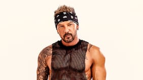 “Estaba muerto de susto”: Fabricio Vasconcelos se sometió a importante cirugía para recuperar movilidad de su brazo tras accidente