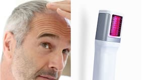 Si no da resultados, prometen devolver la inversión: cómo es el rodillo láser para hacer crecer el pelo