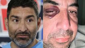 “Nos sacaron la cresta”: relatan brutal pelea en pichanga que involucra a Gamadiel García