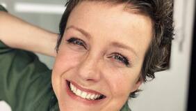 Claudia Conserva se sometió a impactante procedimiento estético: recibió desubicada broma