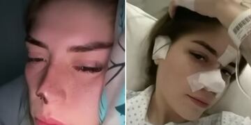 Joven agredida por pareja