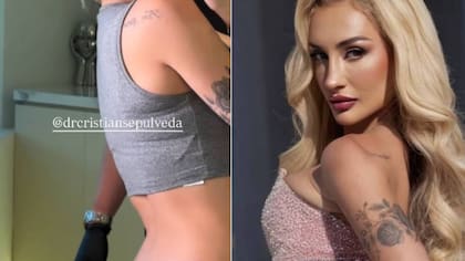 Fran Maira impacta tras someterse a cirugía en íntima zona de su cuerpo: mostró foto sin censura y varios quedaron en shock