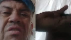 Viralizan tanda de chalazos que recibió Tío Rene por parte de Doctor Makigero: redes están divididas