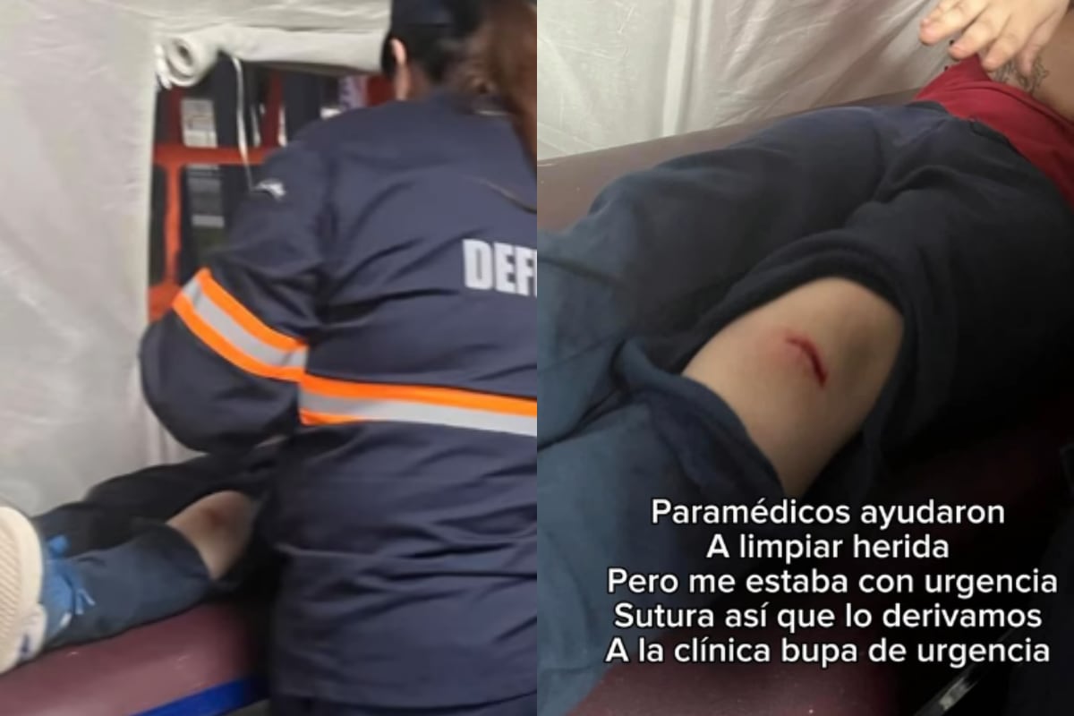 “Pudo ser peor”: madre acusa negligencia tras grave accidente con clavo de su hijo en fonda de Ñuñoa