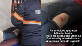 “Pudo ser peor”: madre acusa negligencia tras grave accidente con clavo de su hijo en fonda de Ñuñoa