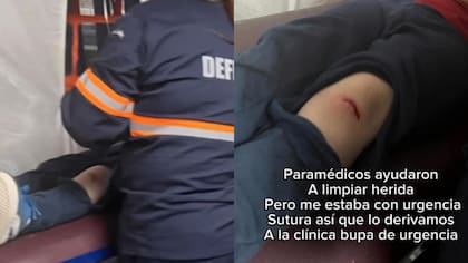 “Pudo ser peor”: madre acusa negligencia tras grave accidente con clavo de su hijo en fonda de Ñuñoa