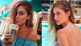 ¿Daniela Castro se operó la nariz?