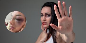 “El abuso no es amor”: modelo de OnlyFans denunció los graves maltratos que sufrió por su expareja