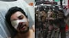 Lapidario fallo contra actuar de Carabineros: el monto que recibirá trabajador víctima de trauma ocular y sus dos hijas