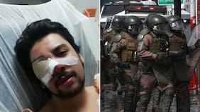 Lapidario fallo contra actuar de Carabineros: el monto que recibirá trabajador víctima de trauma ocular y sus dos hijas