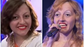 ¿Qué fue de Raquel Castillo, la mujer de las “5 mil imitaciones”?