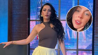 Daniela Aránguiz mostró cómo quedó su rostro tras sufrir una picadura de abeja: “Estoy súper inflamada”