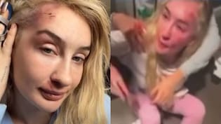 Familia de Fran Maira confirma drástica decisión tras colapso de la cantante por golpiza: hablan de estrés agudo