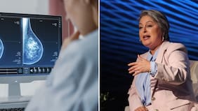 “Mamografías sin dolor”: La propuesta de Jeanette Jara para prevenir el cáncer de mamas