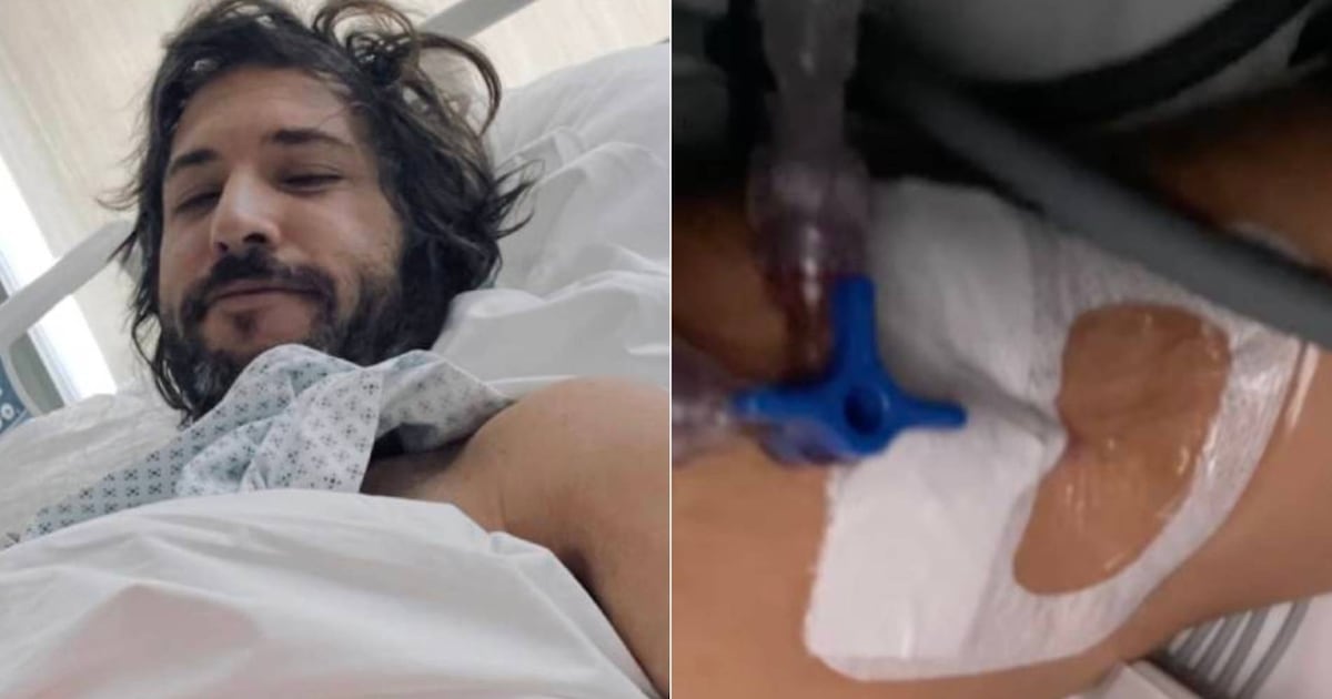 Gonzalo Yáñez: Cantante en Riesgo Vital por Falla Orgánica Severa